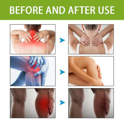 Bee Venom Pain Relief Cream | Buy 1 Get 2 Free 🔥