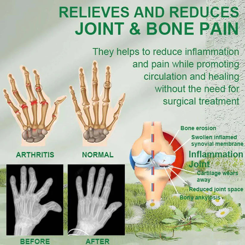 Bee Venom Pain Relief Cream | Buy 1 Get 2 Free 🔥